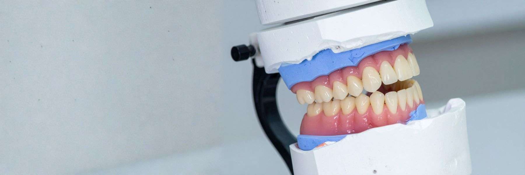 Dentures and Partials | Dentist